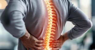 Can a Chiropractor Help with Poor Posture