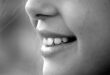 How to Fix Chipped Teeth Without Anyone Knowing They Were Ever Broken