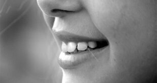 How to Fix Chipped Teeth Without Anyone Knowing They Were Ever Broken