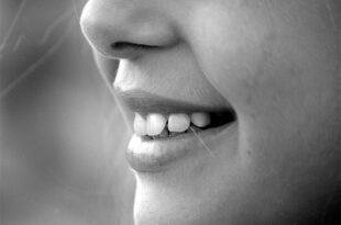 How to Fix Chipped Teeth Without Anyone Knowing They Were Ever Broken